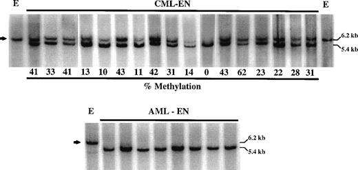 Fig. 2. Examples of ABL1 methylation. The top panel is a representative composite Southern blot of 17 cases of CML restricted either with EcoRI alone (E) or EcoRI and Not I (EN). The band at 6.2 kb (arrow) in the EN lanes represents alleles methylated at the ABL1 Pa promoter. This methylation was quantitated by densitometric analysis of the 6.2-kb band relative to the density of all the bands in each lane. The relative methylation is indicated below each lane and ranges from 0% to 62% in these samples. The bottom panel shows examples of ABL1 methylation analysis of 8 cases of AML. None of these (and other) cases have the 6.2-kb band indicative of methylation of this CpG island.
