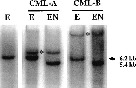 Fig. 3. Methylation analysis of 2 cases of CML in which the translocation breakpoint is within the EcoRI flank. In both cases (CML-A and -B), EcoRI restriction alone (lanes labeled E) results in two distinct bands: a normal band at 6.2 kb and a rearranged band of higher molecular weight (indicated by a star). In both cases, after digestion with Not I (EN lanes), the unrearranged allele is completely digested to a 5.4-kb band, indicating complete lack of methylation. The rearranged allele does not change in size afterNot I digestion, which could be due either to complete methylation or to a breakpoint upstream of the Not I site. For comparison purposes, normal DNA digested with EcoRI alone is shown in lane 1.
