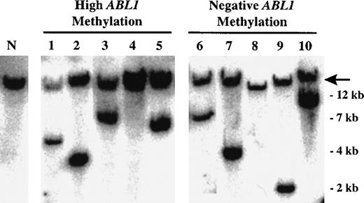 Fig. 5. Detection of BCR rearrangement in negative and high ABL1 methylation groups. Shown are representative (composite) Southern blots of DNA restricted with EcoRI and probed with a BCR cDNA probe. The N lane contains DNA from normal colon, whereas lanes 1 through 10 contain DNA from cases of CML-ECP with either negative or high levels of ABL1 methylation (as indicated on the top of each group). The arrow points to the normal (nonrearranged band). All CML cases except those in lanes 4 and 8 contain additional bands, reflecting the presence of a BCR rearrangement. Quantitation of the rearranged band relative to the normal band showed no differences between the high versus negative methylation groups. Slight variations in the apparent size of the normal band are due to the fact that it runs at greater than 20 kb, an area that is difficult to resolve by Southern analysis.