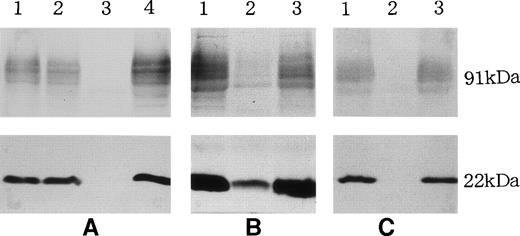 Fig. 2. Immunoblot analyses of neutrophils from CGD patients, T.M. (A), T.H. (B), and J.O. (C). The membrane fractions from neutrophils (1 to 2 × 106 cell equivalents) were electrophoresed and transferred to nitrocellulose membranes, which were treated with antiserum against polypeptides of p22-phox and gp91-phox and stained with Ponceau. (A) Patient T.M. (3), mother (2), and controls (1 and 4). (B) Patient T.H. (2) and controls (1 and 3). (C) Patient J.O. (2) and controls (1 and 3). The protein concentration of the variant CGD (B) loaded was higher than those in other proteins (A and C).
