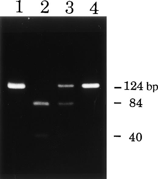 Fig. 6. Restriction digestion analysis of DNA fragments from patient T.M. and his mother. DNA samples (exon 12) from the patient (lane 2) and his mother (lane 3) and healthy controls (lanes 1 and 4) were digested with MspI. DNA from the CGD patient showed abnormal restriction digestion patterns of the gp91-phox gene and that from the mother showed evidence of the carrier state.