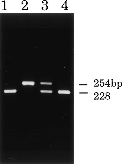 Fig. 7. Restriction digestion analysis of DNA fragments from CGD patient T.H. and his parents. DNA samples (exon 9) from patient T.H. (lane 2), the father (lane 1), mother (lane 3), and a control (lane 4). When digested with Taq I, DNA from patient T.H. showed abnormal restriction fragment patterns and that from the mother showed evidence of a carrier state.