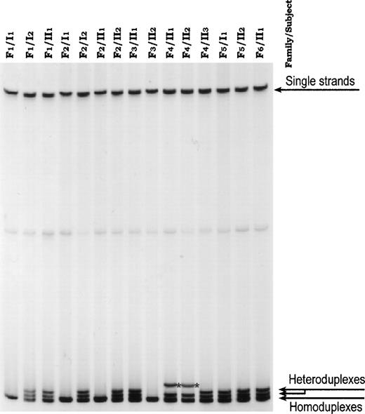 Fig. 1. Heteroduplex analysis of exon 20 of band 3 genomic DNA. In all 11 HS patients, heteroduplexes were visible (they were generated on PCR between normal fragments and fragments carrying the C deletion). *Band shows heteroduplex produced by silent polymorphism occurring in trans.