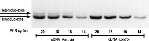 Fig. 2. Mutant band 3 mRNA is detected in patient II1 of family 1. The presence of the cDNA Vesuvio was verified by PCR amplification of reverse-transcribed total reticulocyte RNA. Aliquots of the PCR reaction after 14, 16, 18, and 20 cycles were screened using heteroduplex analysis.