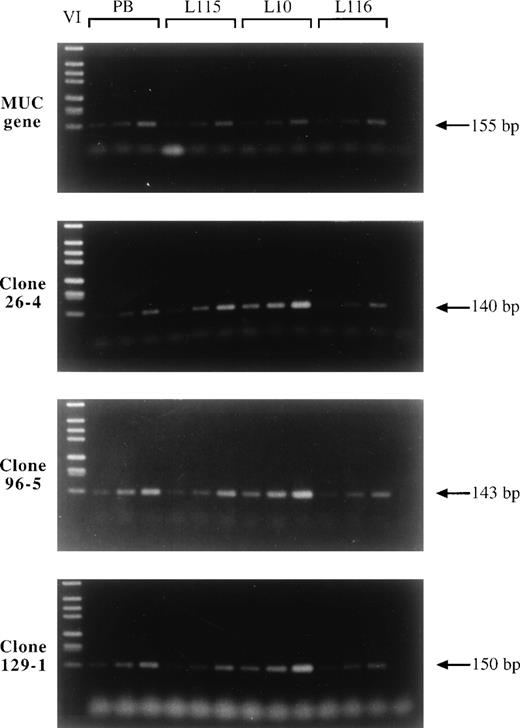 Fig. 3. Amplification analysis of clones 26-4, 96-5, and 129-1 in squamous cell lung carcinomas L115, L10, and L116 by comparative PCR. Three different concentrations of tumor and blood DNA were amplified each by PCR using primers specific for clones 26-4, 96-5, and 129-1 and the MUC gene. The PCR products were separated by gel electrophoresis and visualized by SYBR green I. While the signal intensities of tumor and peripheral blood DNA (PB) were comparable using primers specific for the MUC gene, the signals of all three clones 26-4, 96-5, and 129-1 were significantly increased in tumor DNA L10 versus normal DNA indicating amplification of the corresponding genes in tumor L10. This tumor was used to generate the cDNA expression library. Lower amplification levels or the absence of amplification are observed for tumors L115 and L116, respectively. Lane 1, DNA marker; lanes 2 through 4, three dilutions of blood DNA; lanes 5 through 7, three dilutions of tumor DNA L115; lanes 8 through 10, three dilutions of tumor DNA L10; lanes 11 through 13, three dilutions of tumor DNA L116; lane 14, no DNA.