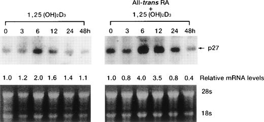 Fig. 7. Time-dependent effects of either 1,25(OH)2D3 alone or in combination with RA on levels of p27KIP1 mRNA in UF-1 cells. Cells were cultured for the indicated durations with either 10−7mol/L 1,25(OH)2D3 alone or in combination with 10−7 mol/L RA. Total RNA (15 μg per lane) was blotted and hybridized with a p27KIP1 cDNA probe. Bottom panel shows the ethidium bromide–stained gel with 28S and 18S ribosomal RNA demonstrating equivalent RNA-loading per lane. Expression of p27KIP1 transcripts relative to the expression in control cells was determined by densitometry.