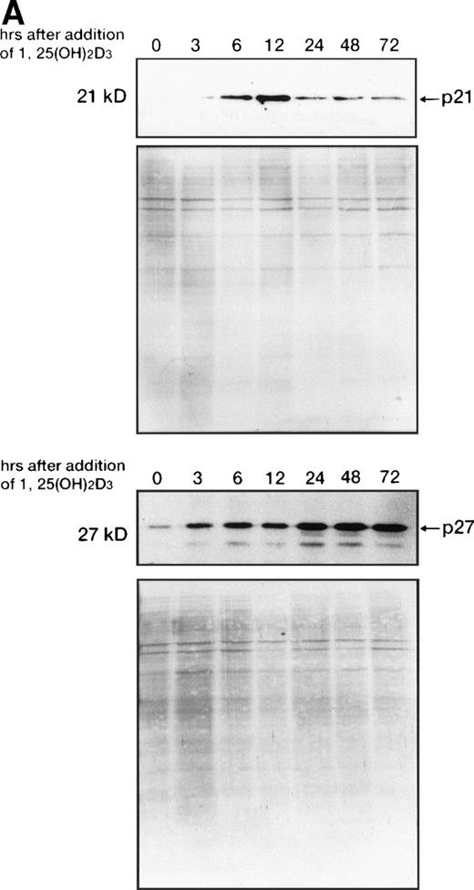 Fig. 8. Western blot analysis of p21WAF1/CIP1and p27KIP1 protein. (A) Total cellular protein (10 μg per lane) from UF-1 cells treated for 3-72 hours with 10−7 mol/L 1,25(OH)2D3 was separated on a 12.5% SDS-polyacrylamide gel and transferred to the membrane. p21WAF1/CIP1 and p27KIP1 protein levels were detected by Western blotting using antibodies directed against p21WAF1/CIP1 and p27KIP1, and then the blots were stained with Coomassie brilliant blue to confirm that equal amounts of protein were present in each lane. (B) Enhanced expression of p27KIP1 protein by exposure of cells to the combination of 10−7 mol/L all-trans RA and 1,25(OH)2D3 for 48 hours.