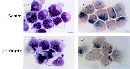 Fig. 1. Morphologic and cytochemical changes in RA-resistant APL cells by 1,25(OH)2D3. UF-1 cells were cultured with either 10−7 mol/L 1,25(OH)2D3 (B and D) or culture media alone (A and C) for 4 days, and cytospin slides were prepared and stained with either Giemsa (A and B) or naphthol AS-D chloroacetate esterase (C and D). Original magnification ×1,000.
