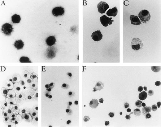 Fig. 3. Representative photographs of May-Grünwald-Giemsa–stained cytospin preparations of cells cultured with different cocktails of cytokines after primary cultures. (A) Unsorted cells in GM-CSF, IL-4, and TNF for 7 days, (B) p14+ cells 3 days in GM-CSF plus IL-4. (C) p14+ cells, 7 days with the same cytokines as (B), with adjunction of TNF for the last 4 days. (D and E) p14−cells after 9 days of culture with GM-CSF plus TNF or GM-CSF plus FLT3-L, respectively. (F) p14− cells 3 days with GM-CSF plus FLT3-L, 4 days with GM-CSF and IL-4, then 4 days with GM-CSF plus IL-4 and TNF. (A, B, and C) Original magnification ×400. (D, E, and F) Original magnification ×250.