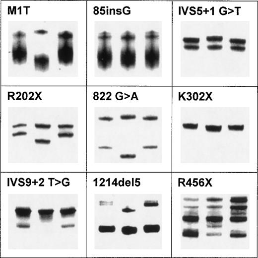 Fig. 1. Examples of SSCA for nine discrete mutations in ERGIC-53. SSCA was performed according to protocol 1 in Materials and Methods. In each panel, the abnormal pattern caused by the mutation is in the middle lane surrounded by two controls.