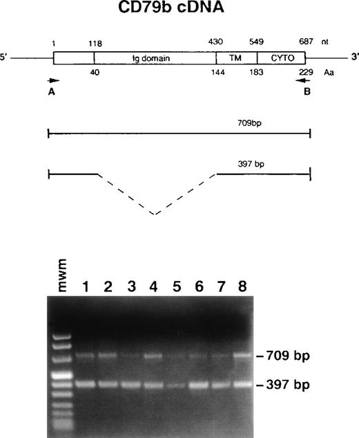 Fig. 1. Strategy to amplify CD79b cDNA by RT-PCR and results. (Top) Numbers above the cDNA scheme represent nucleotide (nt) position (with 1 corresponding to the initiation ATG codon). Numbers below the scheme indicate amino acid (Aa) position. Ig domain indicates the extracellular domain, TM the transmembrane, and CYTO the cytoplasmic segment. Positions of the primers are shown by the arrows. (Bottom) RT-PCR analysis showing the two detected fragments: 709 bp and 397 bp. Lanes 1 through 3 and 5 through 8, different CLL cases; lane 4, normal PBL.