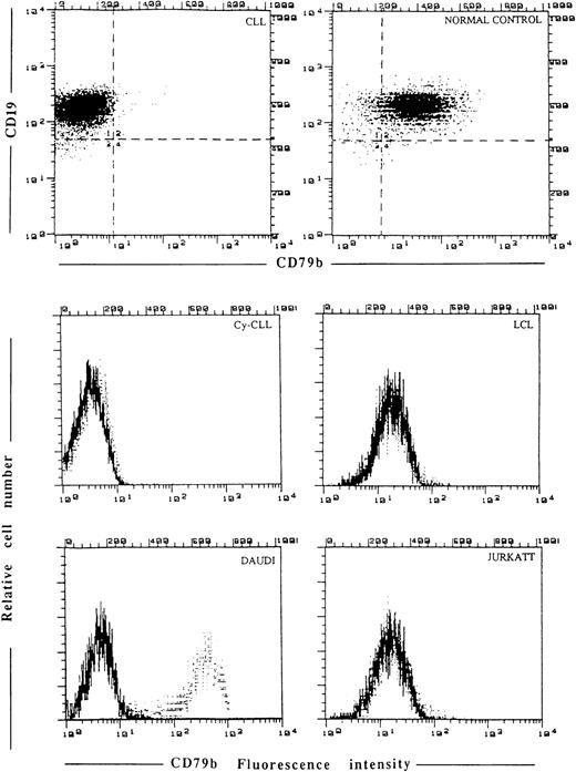 Fig. 3. Cytofluorimetric analysis of CD79b expression by SN8 MoAb. Membrane staining in CLL fresh cells, normal control, LCL, Daudi, and Jurkatt cell lines. In the same CLL cells the possibility that the epitope detected by SN8 might be present in the cytoplasm (Cy-CLL) was ruled out.