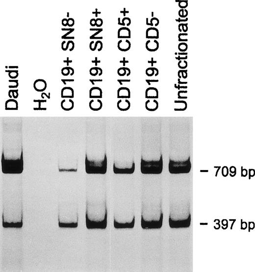 Fig. 4. CD79b and ▵CD79b transcript expression in normal CD5+ compared with CD5− B cells and CD19+, SN8+ compared with CD19+, SN8− normal B cells. One representative experiment of three consecutive samples is shown.
