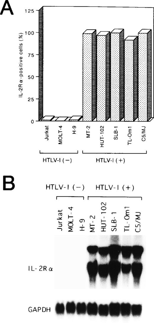 Fig. 2. Expression of IL-2R at protein (A) and mRNA (B) levels in various cell lines. (A) The percentages of positive cells for IL-2R are shown. (B) Total RNA (20 μg of each) was isolated from various cell lines and assessed for IL-2R or GAPDH mRNA expression.
