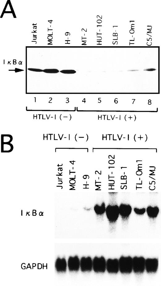 Fig. 3. Expression of IκB at protein (A) and mRNA (B) levels in various cell lines. (A) Whole-cell extracts were isolated from the cells and analyzed by Western blotting using anti-IκB antibody. (B) Total RNA (20 μg of each) was isolated from various cell lines and assessed for IκB or GAPDH mRNA expression.