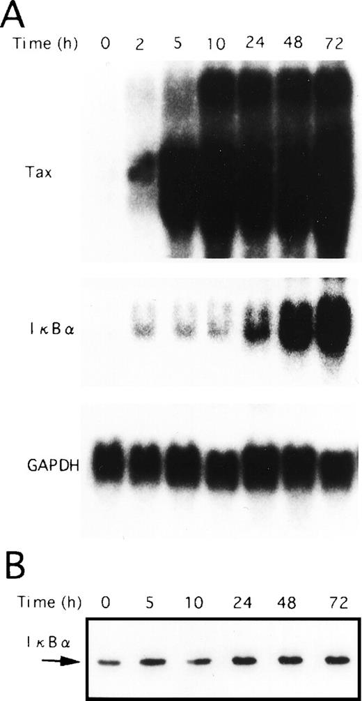 Fig. 4. Tax-induced proteolytic degradation of IκB. JPX-9 cells were incubated with CdCl2 (20 μmol/L) for the indicated time periods and then collected for preparation of either total cellular RNA or whole-cell extracts. (A) Total RNA isolated from either nontreated or CdCl2-treated JPX-9 cells was subjected to Northern blot analysis with Tax, IκB, and GAPDH probes. (B) Whole-cell extracts isolated from CdCl2-treated JPX-9 cells were subjected to Western blotting using anti-IκB antibody.