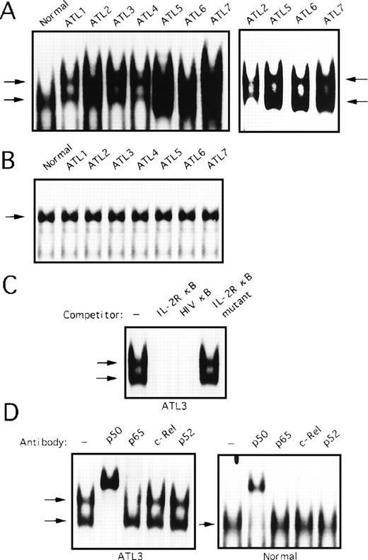 Fig. 7. Activation of NF-κB in primary ATL cells. (A) Nuclear extracts (5 μg) from PBMC from patients with ATL or from healthy subjects (normal) were assessed for activation of NF-κB by EMSA. The right panel represents a lighter exposure of patients 2, 5, 6, and 7. (B) Nuclear extracts from patients with ATL or from healthy subjects (normal) were analyzed for protein binding to the octamer consensus sequence by EMSA. (C) Nuclear extracts from patient 3 sample were coincubated with 100-fold excess of unlabeled oligonucleotides and assessed in parallel. (D) Nuclear extracts were preincubated with NF-κB subunit-specific antibody, as indicated above each lane, before the addition of radiolabeled probe (as in Fig 6).