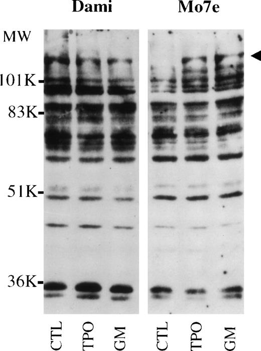 Fig. 6. Tyrosine phosphorylation of cellular proteins in Dami/HEL and Mo7e cells. Cell lysates from Dami/HEL cells (A) and Mo7e cells (B) were cultured in medium without cytokines (CTL), or with 400 ng/mL TPO or 40 ng/mL GM-CSF (GM). The cellular proteins were lysed in SDS buffer, separated on SDS-PAGE, transferred onto PVDF membrane, and probed with antiphosphotyrosine antibodies. The arrowheads indicate cytokine-induced tyrosine-phosphorylated protein bands in Mo7e cells, which are constitutively expressed in unstimulated control Dami/HEL cells.