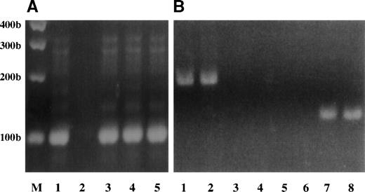 Fig. 9. RT-PCR analysis of BCR/ABL and C-ABL transcripts in Dami/HEL, Meg-01, and K562 leukemic cell lines. (A) C-ABL expression was analyzed by RT-PCR using 1 μg total RNA from K562 (lane 1), Mo7e (lane 3), Dami/HEL (lane 4), and Meg-01 (lane 5) cell lines. RT-PCR was performed without cellular RNA as a negative control (lane 2). (B) BCR/ABL expression was analyzed by RT-PCR using 0.01 μg or 1 μg total RNA from K562 cells as positive controls (lanes 1 and 2), or using 1 μg of total RNA from Mo7e cells treated without (lane 3) or with 100 ng/mL TPO (lane 4), from Dami/HEL cells treated without (lane 5) or with 100 ng/mL TPO (lane 6), and from Meg-01 cells treated without (lane 7) or with 100 ng/mL TPO (lane 8). The sizes of PCR products are indicated in base pairs.