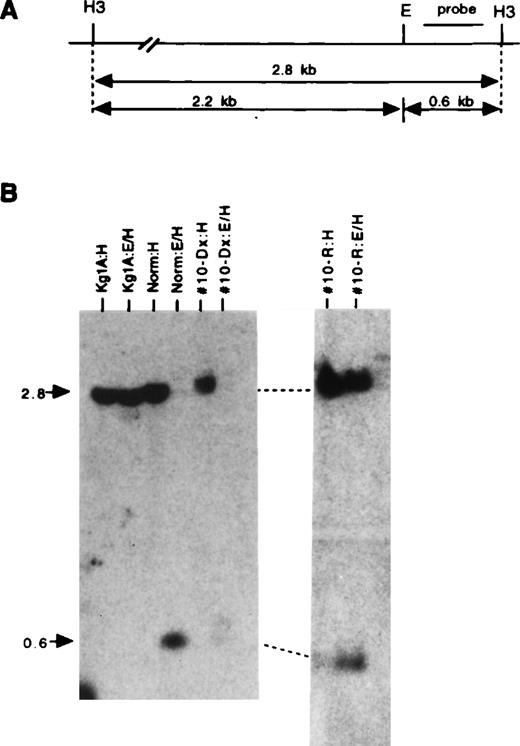 Fig. 2. p15 promoter hypermethylation. (A) Schematic representation of p15 exon 1 and surrounding HindIII (H3) and EagI (E) sites. The p15 probe used (indicated above) hybridizes to exon 1. A 2.8-kb band is seen when the samples are digested with HindIII alone. When the samples are digested withEagI (a methylation-sensitive enzyme) in combination withHindIII, a 0.6-kb band is recognized by the probe if the gene is unmethylated (cuts at EagI) and a 2.8-kb band is present if the sample is methylated (does not cut at EagI) (note that a 2.2-kb band is not seen, because the exon 1 probe does not hybridize to this region of DNA). (B) Autoradiogram of a blot containing HindIII and EagI-in combination with HindIII-digested DNAs hybridized with the p15 exon 1 probe. The locations of the expected 2.8-kb and 0.6-kb bands are indicated by arrows at the left. Samples include DNA from Kg1A cell line, a healthy control (NORM), DR#10 at diagnosis (Dx) and at relapse (R). Homozygous methylation is seen in Kg1A, and hemizygous methylation in DR#10 at relapse, but not at initial diagnosis.