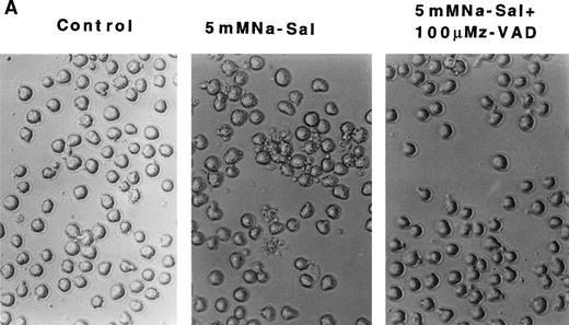 Fig. 4. z-VAD prevents Na-Sal–induced apoptosis of TF-1 cells. (A) Morphological changes. TF-1 cells were left untreated (control) or were treated with 5 mmol/L Na-Sal for 5 hours with or without 1-hour pretreatment with 100 μmol/L Z-VAD. fmk (Calbiochem) as indicated. (B) z-VAD prevents caspase-3 activation. Cells were left untreated (control) or were treated with 5 mmol/L Na-Sal alone or in the presence of 100 μmol/L Z-VAD for 16 hours. Caspase-3 activity was determined as described in Materials and Methods. (C and D) Z-VAD prevents Na-Sal–induced cleavage of gelsolin (C) and PARP (D). Cells were untreated (lane 1), or treated with 5 mmol/L Na-Sal for 5 hours in the absence (lane 2) or presence of 100 μmol/L Z-VAD (lane 3). The assays for PARP and gelsolin cleavage are described in the legend to Fig 3.