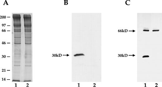 Fig. 2. SDS-PAGE of mouse RBC membrane proteins showing the absence of immunoreactive protein 7.2b in homozygous 7.2b knock-out mouse RBC. Lane 1, control mouse; lane 2, homozygous 7.2b knock-out mouse. (A) SDS-PAGE gel stained with coomassie blue. A 30-kD band is seen in both wild-type and 7.2b knock-out mouse samples, reflecting the presence of several non-7.2b RBC membrane proteins normally found in this region.2 (B) Immunoblot of SDS-PAGE gel prepared with affinity-purified rabbit polyclonal antihuman protein 7.2b antibody. (C) Immunoblot of SDS-PAGE gel prepared with monoclonal murine antimouse protein 7.2b antibody. Immunoreactive 7.2b is absent from the RBC membranes of the knock-out mouse.