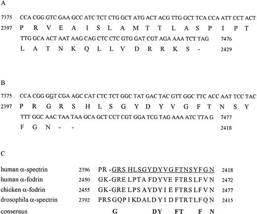 Fig. 1. cDNA sequence and deduced amino acid sequence of C-terminus human -spectrin. (A) Published sequence. (B) Corrected sequence. The addition of G (underlined base) cause a change in reading frame resulting in a molecule 11 amino acids shorter (2418 residues instead of 2429) and different in amino acid sequence 2399-2418. (C) Comparison of C-terminus amino acid corrected sequence of human -spectrin (underlined sequence), human -fodrin, chicken -fodrin, drosophila -spectrin.