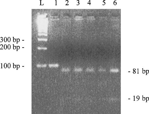 Fig. 2. Agarose gel electroforesis of PCR products digested byScrFI. Lane 1 is uncut control. Lanes 2 to 6 are digested PCR products (only 5 of the 16 samples are showed). L represents the ladder.