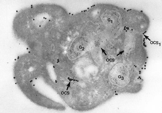 Fig. 1. Cryosection of blood platelet from a washed cell suspension incubated with 18- to 20-nm colloidal gold particles coated with Fgn/Au for 5 minutes, then exposed to 1 U/mL of thrombin for 60 seconds. The Fgn/Au particles bind to the cell surface and penetrate into peripheral channels of the OCS. After fixation, freezing, and cryotomy, the frozen thin section was stained with a polyclonal antifibrinogen antibody and protein A bound to 5-nm gold particles. Immunogold beads detecting endogenous fibrinogen are concentrated in intact granules (G3) and in granules (G1, G2) in the process of discharging their contents into channels of the OCS. Some of the Fgn/Au particles entering from the outside are mixed with the immunogold beads in the same OCS channels (OCS) communicating with the exterior surface. Original magnification ×60,000. (Reprinted with permission.18)