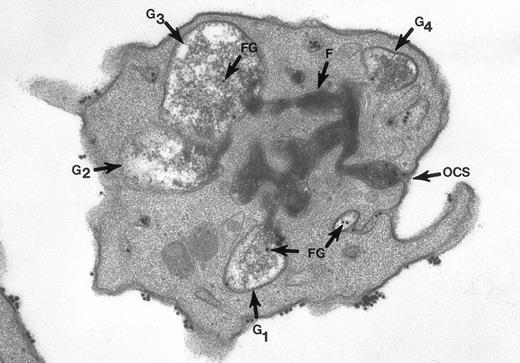 Fig. 2. Thin section of a platelet from a sample of washed cells incubated with Fgn/Au particles for 15 minutes, then exposed to 5 U/mL of thrombin for 60 seconds before fixation in glutaraldehyde-tannic acid-osmium to selectively stain the platelet glycocalyx, fibrinogen, and fibrin. This example is one of several serial sections through the same platelet. It and the other serial sections show the typical features of shape change and internal transformation caused by thrombin. Fgn/Au particles are bound to the irregular surface and are in the process of entering channels of the OCS. The OCS channel indicated by an arrow (↑) is filled with fibrinogen and fibrin stained by tannic acid-osmium black. The tortuous channel is connected directly to several granules (G1, G2, G3) in various stages of labelization. Residual fibrinogen is stained by the reaction product. Fgn/Au particles carried by the OCS have entered the granules (G1, G3, G4). The direct connections between OCS channels and granules in this example and its serial sections is indisputable. Original magnification ×45,000. (Reprinted with permission.19)