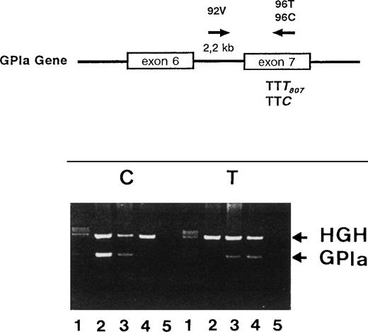 Fig. 1. Schematic illustration of the localization of the primers for genotyping of C807T dimorphism (top). Allele-specific amplification (PCR-SSP) was performed with intronic common sense primer (92V) and antisense primers C807 or T807 (96C or 96T). Representative results of GPIa genotypes determined by PCR-SSP of three individuals: homozygous CC (lanes 2), heterozygous CT (lanes 3), and homozygous TT (lanes 4). Genomic DNA were amplified using specific primer for C807 (left panel) or for T807 allele (right panel) and were analyzed on 1.8% agarose gel electrophoresis. The GPIa bands represent the allele-specific PCR product and the HGH bands the internal control. DNA size standards V (Boehringer Mannheim) were used as standard (lanes 1). Negative controls are shown in lanes 5.