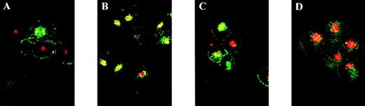 Fig. 3. CD4-independent internalization of CXCR4 and gp120 in early endosomes. CD4−/CXCR4+ CHO-K1 cells were incubated in medium alone (A), in medium with 10 μg/mL of SDF1 (B), or in medium with 10 μg/mL of gp120 wt (C and D) in the presence of 125 μg/mL of Texas Red-conjugated transferrin for 1 hour at 37°C. After fixation and permeabilization, cells were stained with the FITC-conjugated anti-CXCR4 12G5 MoAb (A, B, and C) or the anti-gp120 110-4 MoAb and an FITC-conjugated antimouse IgG (D). The intracellular localizations of CXCR4 and transferrin (A, B, and C) or gp120 and transferrin (D) were analyzed by confocal microscopy. Yellow spots are indicative of the colocalization of transferrin (red) with either CXCR4 (green) or gp120 (green) in early endosomes.