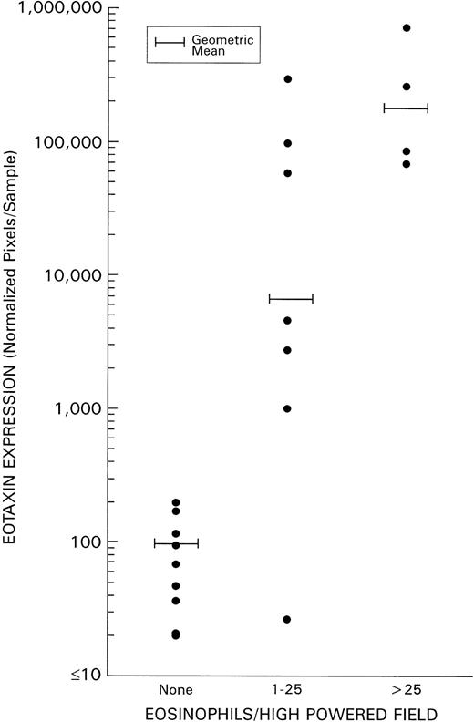 Fig. 5. Correlation of eotaxin mRNA expression and grade of tissue eosinophilia in HD. Tissue eosinophilia was quantified by counting the mean number of eosinophils/high powered field (at least 20 high powered fields were examined in each specimen). Tissue samples were classified as having 0 eosinophils/high powered field; 1 to 25 eosinophils/high powered field; or >25 eosinophils/high powered field.