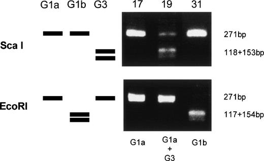 Fig. 3. Genetic classification of TTV by digesting the amplified products with endonucleases. Three lanes on the left side schematically represents digestion patterns of the amplified products of G1a, G1b, and G3 subtypes. Three lanes on the right side are photographs of the gel stained with ethidium bromide on which amplified products from UPN 17, 19, and 31 were electrophoresed after digestion with an endonuclease, ScaI, or EcoRI.