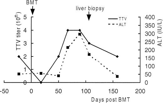 Fig. 4. Serial changes in serum TTV titer and serum ALT level in UPN21.