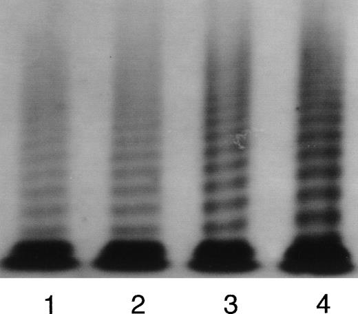 Fig. 3. Representative autoradiographic image of vWF multimers from a subject receiving rHuG-CSF. The origin of the gel is at the top. Lane 1, normal plasma pool; lane 2, plasma from the subject before the rHuG-CSF administration (T0); lane 3, plasma from the subject after 2 days rHuG-CSF administration (T1); lane 4, plasma from the subject after 5 days rHuG-CSF administration (T2).