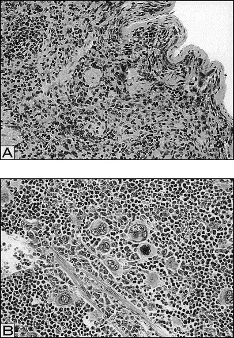 Fig. 6. Histopathological analysis of megakaryocytes in spleens of irradiated (A) and 5 d RAMPS mice (B). Megakaryocyte numbers appear markedly decreased in irradiated mice, whereas the 5 d RAMPS mice appear to have marked increases in the spleen sections. Increased numbers of megakaryocytes appear associated with increased size (hematoxylin and eosin; original magnification × 100).