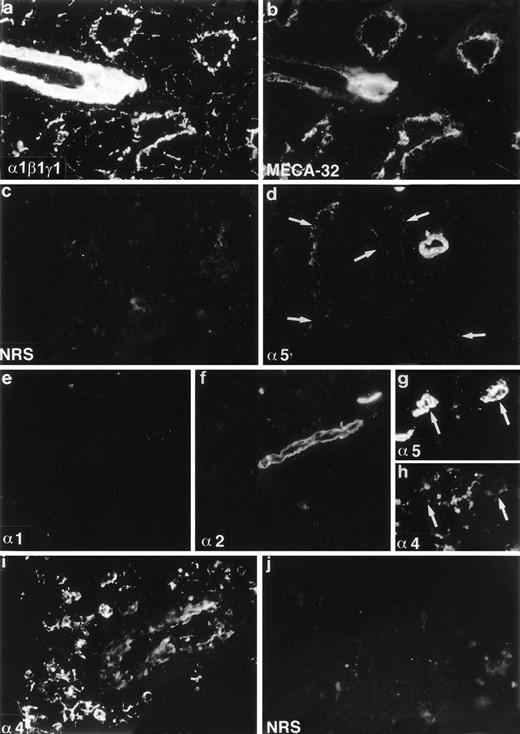 Fig. 2. Expression of laminin polypeptides in the adult mouse bone marrow (a-f), and human bone marrow (g-j). Double immunofluorescence staining with an antiserum reacting with laminin 1, β1, and γ1 polypeptides (a) and with an endothelial cell marker MECA-32 (b) shows expression of either laminin 1, β1, or γ1 chains in the artery, sinusoidal subendothelial basement membranes, and in the intersinusoidal spaces. Immunostaining with MoAb 4G6 (d) shows expression of laminin 5 chain in the arteriolar walls and in the subendothelial basement membrane of the sinusoids (arrows). Immunostaining with antibody 200 specific for laminin 1 chain (e) is negative. Laminin 2 chain, identified with antibody 8G11-D10 (f) is present only in the arteriolar walls. Laminin 4, identified with a polyclonal antiserum against a synthetic peptide corresponding to laminin 4 chain, is localized in the intersinusoidal spaces (h,i), and in the walls of arteries (i). Double immunofluorescence staining with antibody 4C7 against human laminin 5 chain (g) and with the antiserum against synthetic peptide of laminin 4 chain (h) shows expression of 5 and 4 chains in the arteriolar walls (arrows), and 4 chain also in the intersinusoidal connective tissue. Control immunostainings with nonimmune rabbit serum (NRS) (c, j) are negative. Laminin polypeptide chains detected by each antiserum or antibody are indicated in the lower left corners of the figures.