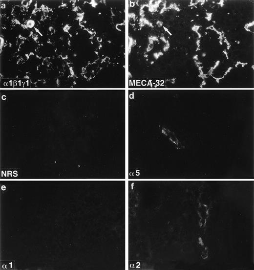 Fig. 3. Expression of laminin polypeptides in newborn mouse bone marrow. Immunostaining with an antiserum reacting with laminin 1, β1, and γ1 chains (a) shows widespread expression of some of these chains in the arteriolar walls (arrow), in the sinusoids, and in the intersinusoidal spaces, as shown by a double immunofluorescence with MECA-32 to stain endothelial cells in the sinusoids and in the arteriole (arrow) (b). Antibodies 4G6 reacting with laminin 5 polypeptide (d) and 8G11-D10 recognizing laminin 2 chain (f) and show a reaction in some arterioles. Laminin 1 chain, identified with MoAb 198, (e) is not expressed in the newborn bone marrow. Control staining (c) with nonimmune rabbit serum (NRS) is negative. Laminin polypeptide chains detected by each antiserum or antibody are indicated in the lower left corners of the figures.