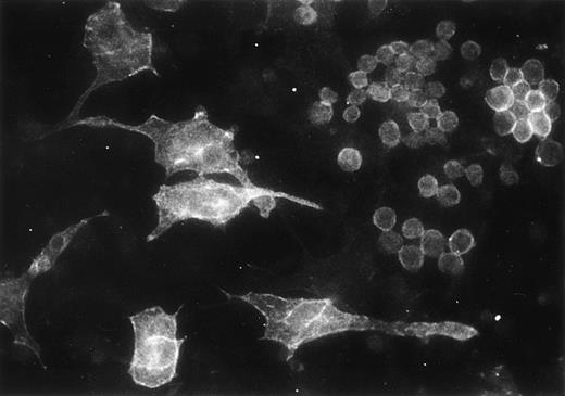 Fig. 9. Immunofluorescent localization of integrin 6 chain in the adherent cells of mouse myeloid long-term bone marrow culture, studied with GoH3 antibody.