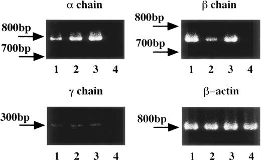 Fig. 1. FcɛRI gene expression in human platelets and HML-1 cells. The FcɛRI gene expression in human platelets (total number: 1 × 108, purity: >99%) and in the human megakaryocyte like cell line, HML-1 cells (total number: 1 × 107) was analyzed by RT-PCR. 1 × 107 human peripheral white blood cells were used as positive control and 1 × 107 of the human erythroleukemic cell line, K562 cells were used as negative control. FcɛRI , β, and γ chain gene segments from 1 μg of each cDNA sample were PCR amplified in the presence of specific sense and antisense primers. Lane 1: human peripheral white blood cells; lane 2: human platelets; lane 3: human megakaryocyte-like cell line, HML-1 cells; lane 4: human erythroleukemic cell line, K562 cells as negative control.