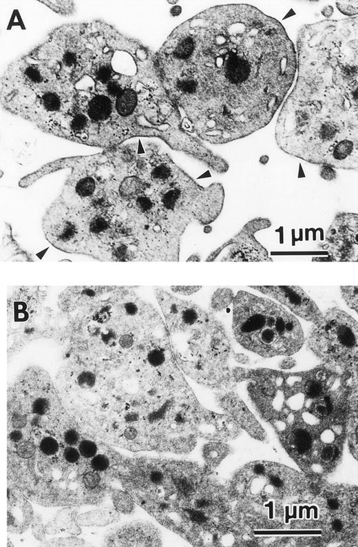 Fig. 7. Immunolocalization of the FcɛRI in human platelets. Localization of the FcɛRI chain in human platelets was examined by immunoelectromicroscopy after staining with the antihuman FcɛRI chain MoAb (CRA1), using the indirect immunoperoxidase method. (A) FcɛRI chain was localized to the cell-surface (arrow head) of human platelets. (B) Negative control with isotype-matched control Ab shows no cell-surface staining.
