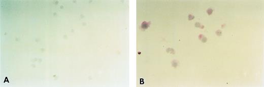 Fig. 5. Expression of the FcɛRI in HML-1 cells. The cell-surface expression of the FcɛRI in HML-1 cells (A) was analyzed, by immunohistochemistry after staining with the antihuman FcɛRI chain MoAb (CRA1) using the APAAP method. The intracytoplasmic expression of the FcɛRI in HML-1 cells (B) was analyzed, by immunohistochemistry as described above after permeabilization with saponin. Although no immunoreactivity was detected for the FcɛRI chain on the cell surface of HML-1 cells, FcɛRI chain expression was clearly detected in the cytoplasm of HML-1 cells.