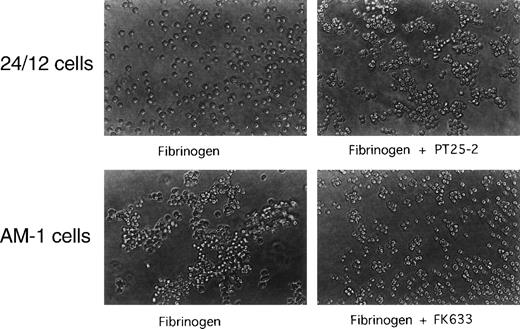 Fig. 2. Spontaneous, fibrinogen-dependent aggregation of AM-1 cells. Cells were resuspended in Tyrode’s buffer in the presence of 300 μg/mL of fibrinogen and with or without 20 μmol/L FK633 or 20 μg/mL PT25-2. Cells were then rotated for 20 minutes on a horizontal rotator. Aggregate formation was stopped by adding equal amount of 0.5% formaldehyde and incubating for 30 minutes. Shown are photographs representative of three independent experiments.