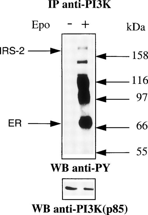Fig. 1. PI 3-kinase associates with several tyrosine-phosphorylated proteins in Epo-stimulated cells. UT-7 cells were serum- and growth factor-starved for 18 hours and incubated for 10 minutes in the presence (+) or absence (−) of 10 U/mL Epo. The cells were then lysed using 1% Brij 98 and the lysates were cleared by centrifugation (27000g for 15 minutes). Lysates from 107 cells were immunoprecipitated using anti–PI 3-kinase antibodies. Immunoprecipitates were analyzed by Western blot using antiphosphotyrosine antibodies (anti-PY) and anti–PI 3-kinase (anti–PI3-K) antibodies, successively.