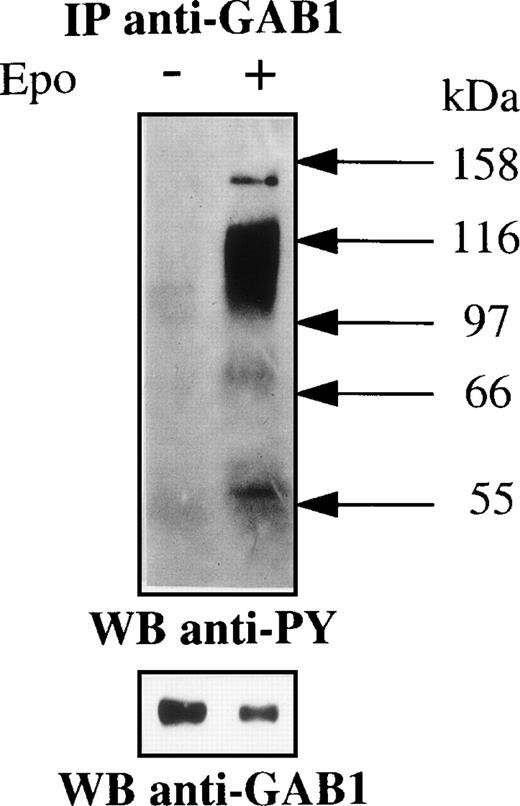 Fig. 7. Epo induces the tyrosine phosphorylation of GAB1 in normal erythroid progenitors isolated from human cord blood. A purified population of human erythroid progenitor cells was prepared as described in Materials and Methods. The cells were serum- and growth factor-deprived by overnight incubation in Iscove’s DMEM containing 0.4% deionized BSA and 25 μg/mL iron-saturated human transferrin. The cells were then stimulated (+) or not (−) for 10 minutes with 10 U/mL Epo. Lysates from 20 × 106 cells were immunoprecipitated with anti-GAB1 antibodies and analyzed by Western blot using antiphosphotyrosine (anti-PY) and anti-GAB1 antibodies, successively.