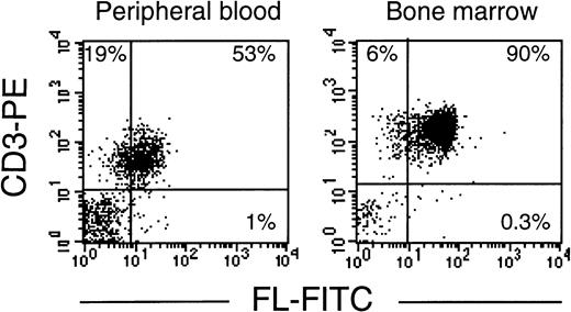 Fig. 3. T lymphocytes express FL on the cell surface in chemotherapy-induced aplasia. Flow cytometric analysis of membrane-bound FL in PBMC or BMMC stained with PE-conjugated anti-CD3 MoAb and FITC-conjugated anti-FL MoAb M5. Analysis was performed with 4 patients; representative results for patients B.G. and K.B. are shown.
