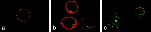 Fig. 4. Two-color immunofluorescence confocal microscopy analysis of FL expression in T lymphocytes. PBMC were settled on the slides, fixed with paraformaldehyde, permeabilized with 0.1% saponin, and stained with anti-FL MoAb M5 followed by FITC-labeled goat antirat IgG and with anti-CD3 antibody followed by Cy3-labeled goat antimouse IgG. (a) Donor cells, staining with anti-CD3 (red) and control rat IgG2a followed by secondary FITC-labeled goat antirat IgG (no signal). (b) Donor cells stained for CD3 (red) and FL (green). (c) Patient’s cells (M.T.) stained for CD3 (red) and FL (green). CD3 staining of patient’s cells was partly destroyed during handling due to drug-related fragility of cell membranes. Areas of overlap are highlighted in yellow.