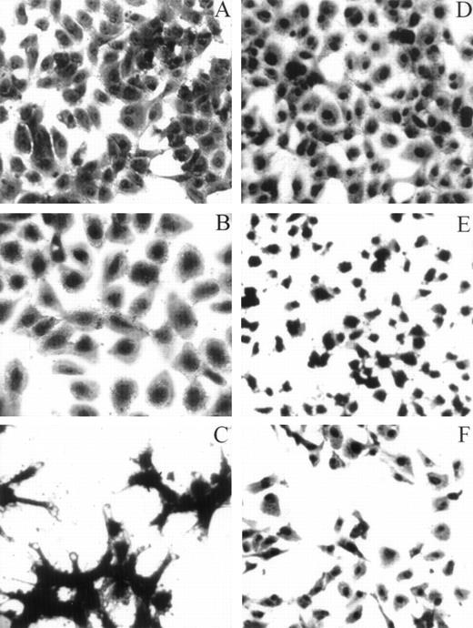 Fig. 6. HUVECs adherent to various substrata examined by light microscopy. For the adhesion assay, refer to the legend for Fig 4A. Whenever inhibitors were used, HUVECs were preincubated with either LJIb1 or echicetin for 15 minutes on ice before being applied, together with the inhibitors, onto the precoated plate. This figure shows the morphology of HUVECs adherent to different ligands observed under light microscopy. HUVECs adherent to vWF (A), alboaggregin A (B), and alboaggregin B (D) showed extensive cell spreading, whereas cells attached to echicetin (C) showed cell clumping without prominent cell spreading. The presence of 50 μg/mL LJIb1 (E) or 500 nmol/L echicetin (F) demonstrated inhibition of cell adhesion and cell spreading on alboaggregin B.