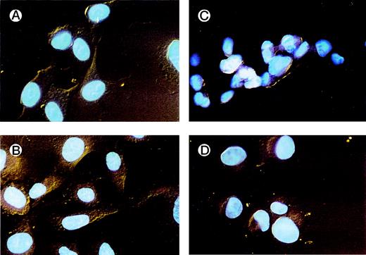 Fig. 7. HUVECs adherent to various substrata examined by fluorescence microscopy. HUVECs were allowed to adhere to different ligands on chamber slides. After fixation with formaldehyde and staining with sulforhodamine and DAPI, the slides were examined by fluorescence microscopy. Details of the nuclei and the cytoplasm were better visualized using this dual stain. HUVECs adherent to vWF (A) and alboaggregin B (B) demonstrated extensive cell spreading, whereas HUVECs adherent to echicetin (C) and echistatin (D) showed minimal cell spreading.